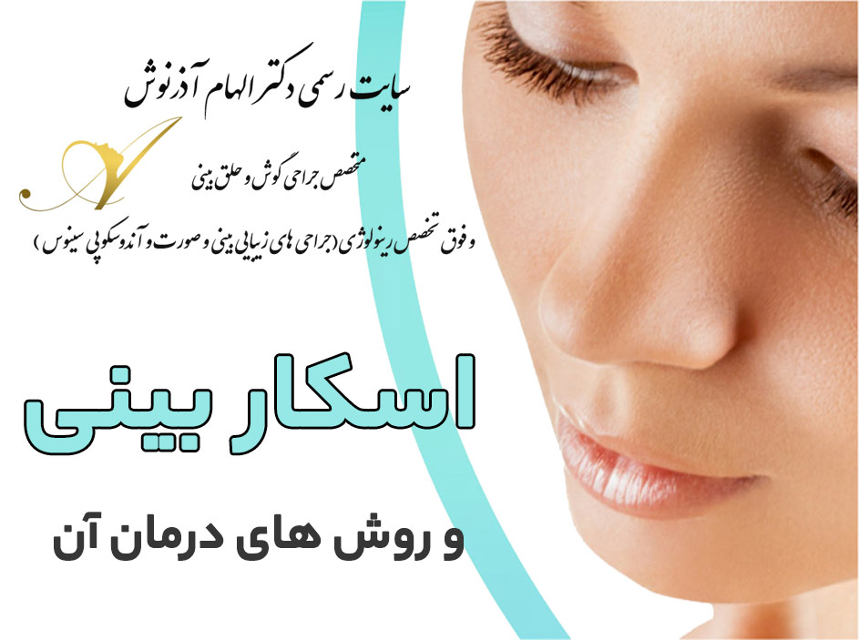 اسکار بینی