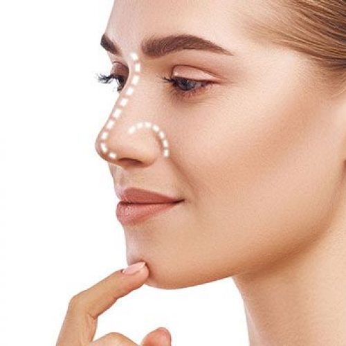 revision-rhinoplasty-package